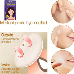 Acne Patches Hydrocolloid Zit Cover Blemish Spot Stickers Face Skin