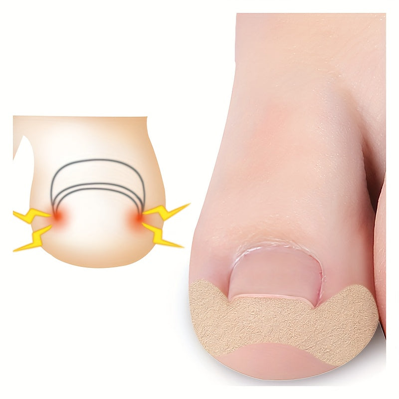 Glue Nail Patch for Toe Nails - Toe Ingrown & Groove Correction