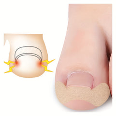 Glue Nail Patch for Toe Nails - Toe Ingrown & Groove Correction