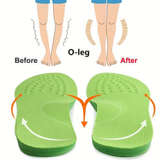 O Shaped Leg Correction Insoles Men's & Women's, Long Term Use
