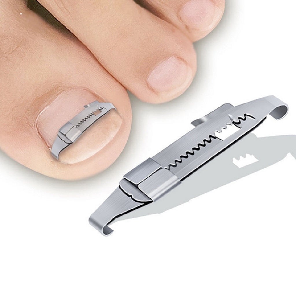 Ingrown Toenail Corrector Pedicure Tool Bunion Foot Care Paronychia Pedicure