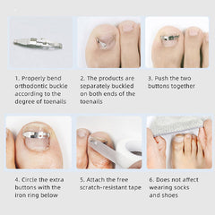 Ingrown Toenail Corrector Pedicure Tool Bunion Foot Care Paronychia Pedicure