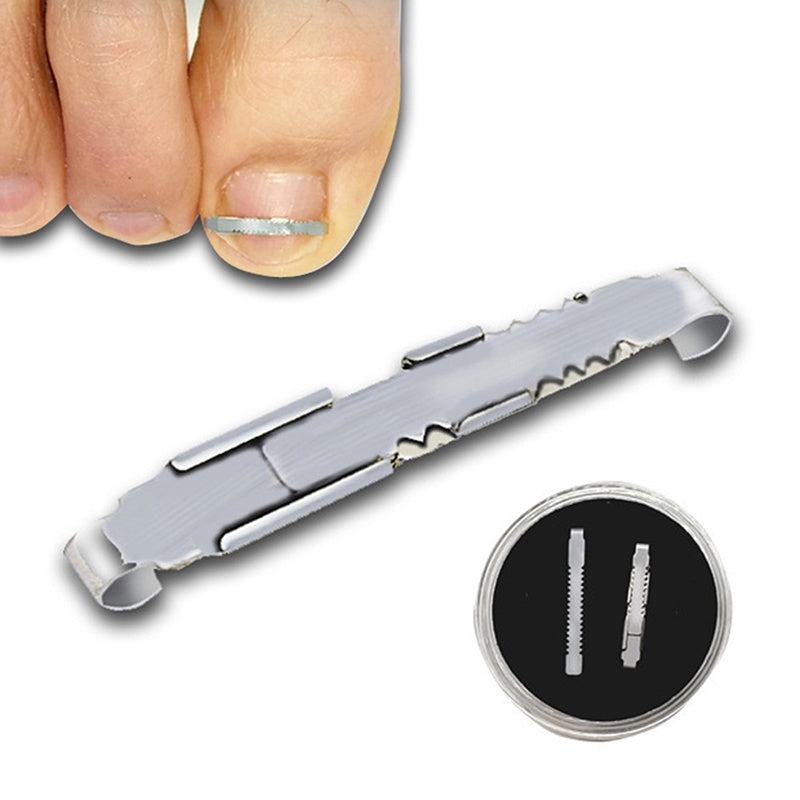 Ingrown Toenail Corrector Toe Nail Treatment Professional Foot Care Tool