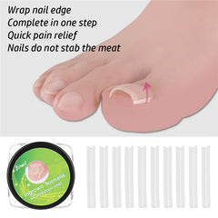 12pcs Ingrown Toe Nail Treatment Corrector Elastic Patch Sticker S