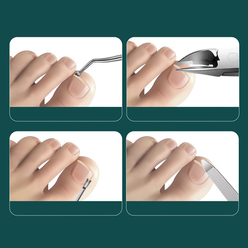 Stainless Steel Ingrown Toenail Plier for Pedicure Care