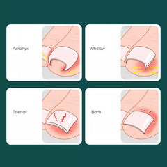 Stainless Steel Ingrown Toenail Plier for Pedicure Care