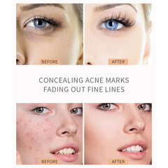 Liquid Concealer Pencil for Spots and Acne Dark Circles