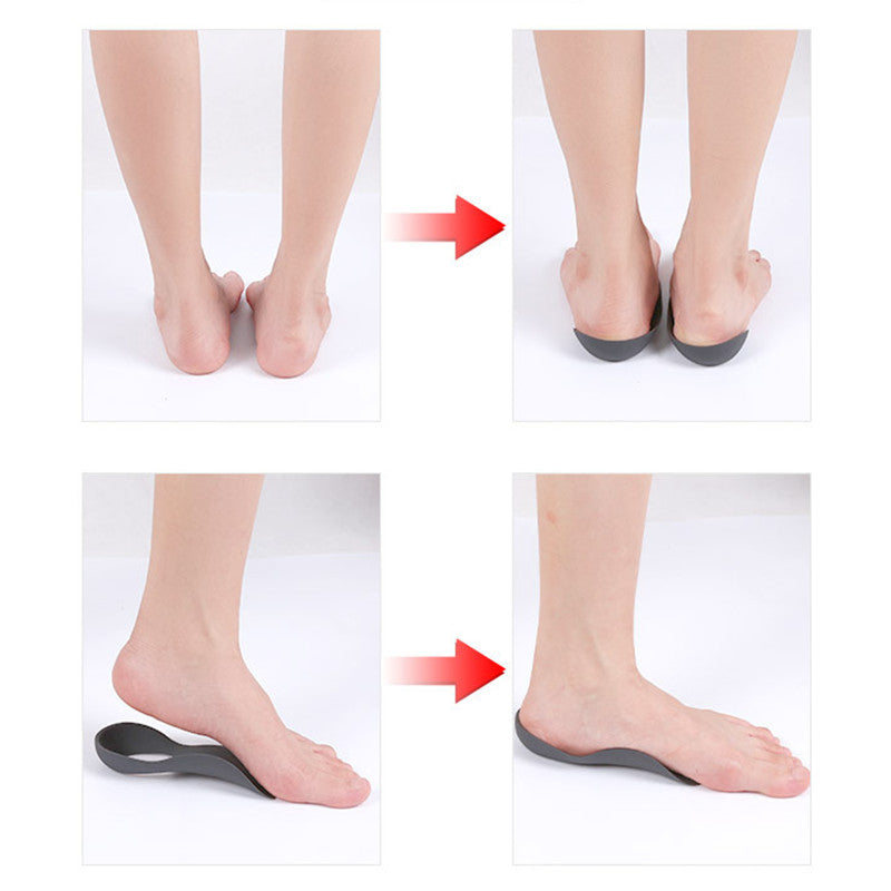 Orthotic Arch Support Insoles Flat Feet Plantar Fasciitis XO Legs Correction