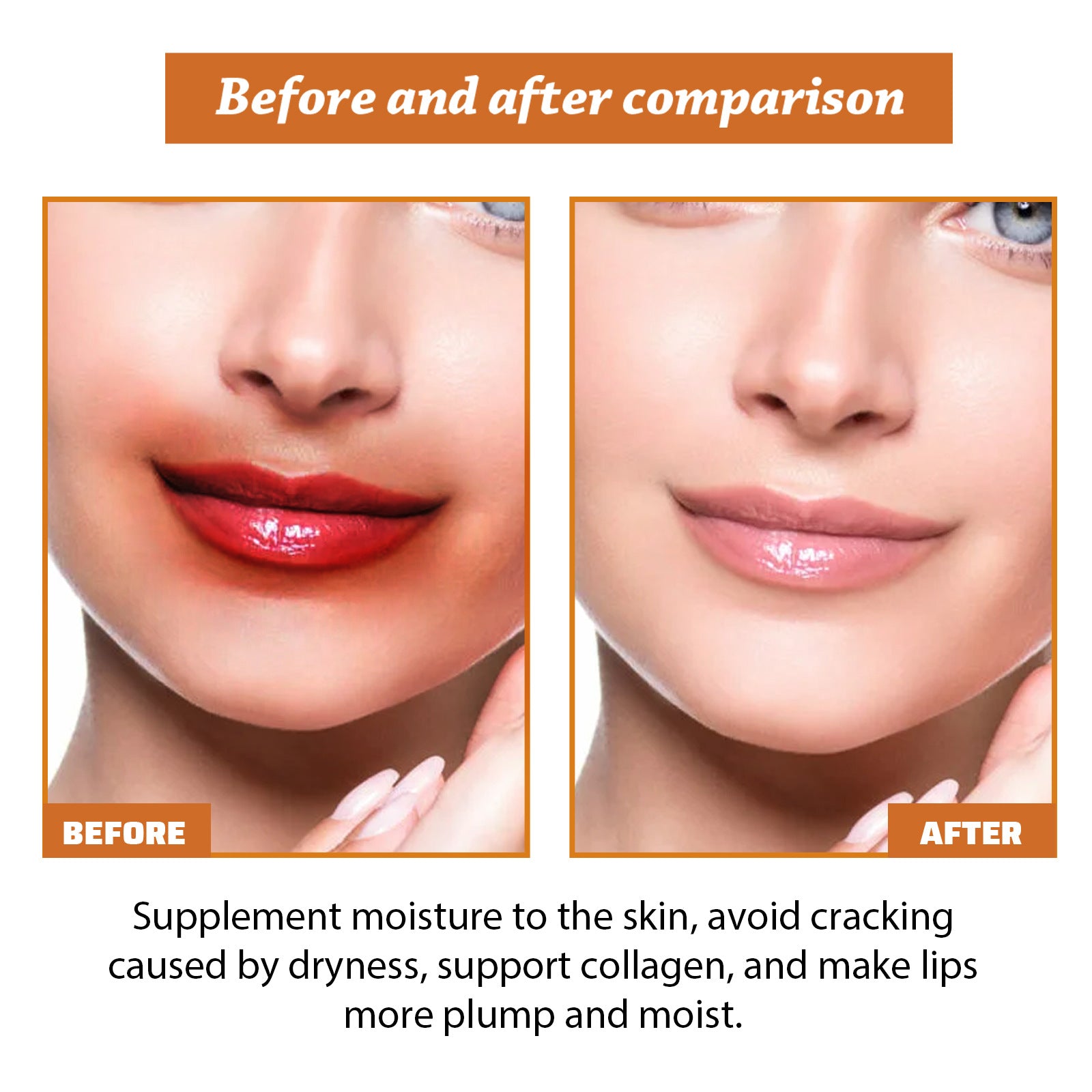 2pcs 50g Pigment Spot Care Cream, Lip Line Repair, Moisturize, Dead Skin Repair