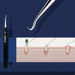 6pcs Blackhead Removal Acne Clip Face Cleaning Tool Set