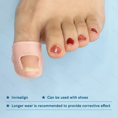 Ingrown Toenail Protection Cover Foot Care Tool 2pcs 4pcs