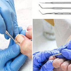3pcs Ingrown Toenail Removal Tool and File Set Stainless Steel Pedicure Kit