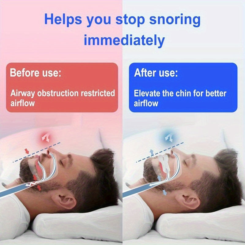 Silicone Teeth Protector for Grinding and Clenching Teeth