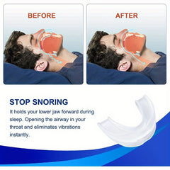 Silicone Teeth Protector for Grinding and Clenching Teeth