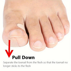 60pcs 10sheets Ingrown Toenail Sticker And Adhesive Elastic Toenail Patch