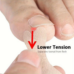 60pcs 10sheets Ingrown Toenail Sticker And Adhesive Elastic Toenail Patch