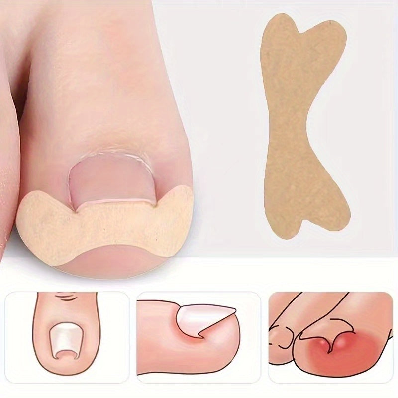 60pcs 10sheets Ingrown Toenail Sticker And Adhesive Elastic Toenail Patch