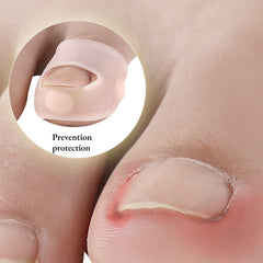 Silicone Ingrown Nail Correction Toe Device