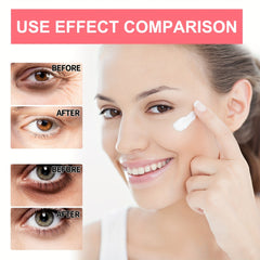 Retinol Eye Stick Dark Circle Eye Bag Fine Line Firm Skin Daily Care