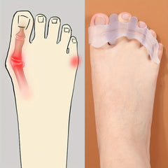 Silicone Gel Forefoot Cushion Pad for Foot Health & Hallux Valgus Correct