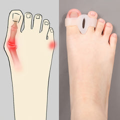 Soft Silicone Toe Separator for Hallux Valgus Correction
