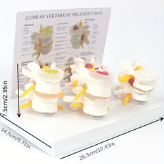 Lumbar Vertebrae Lesion Model Teaching Tool