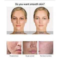 Golden Snail Face Serum Booster Serum Moisturizing And Hydrating