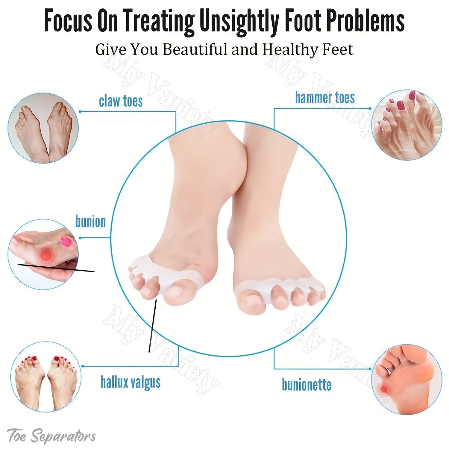 Silicone Toe Separator Gel Bunion Corrector Spreader