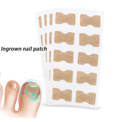 50pcs Glue Nail Correction Device Toe Nail Deformation Patch
