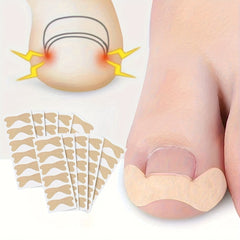 60pcs 10sheets Ingrown Toenail Sticker And Adhesive Elastic Toenail Patch
