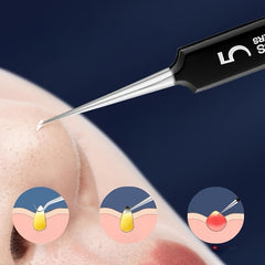 6pcs Acne Needle Set for Precise Acne Extraction