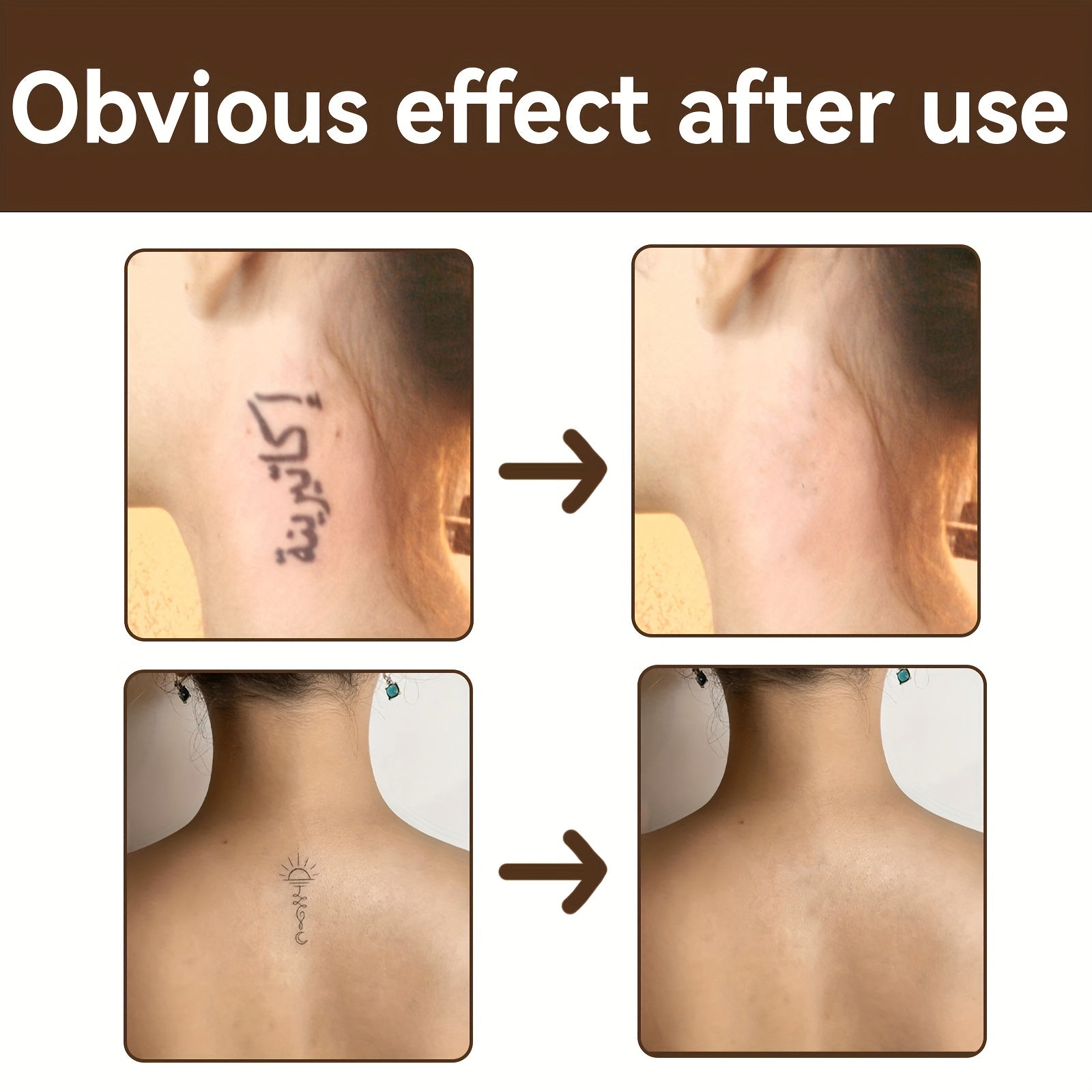 Acne Mark Concealer Liquid Dark Circle Spot Tattoo Scar Cover