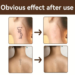 Acne Mark Concealer Liquid Dark Circle Spot Tattoo Scar Cover