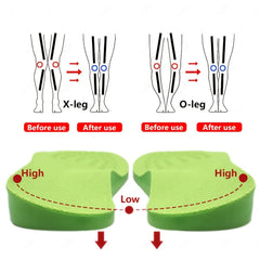 Orthopedic Shoe Pads with Arch Support for Leg Beauty & Comfort
