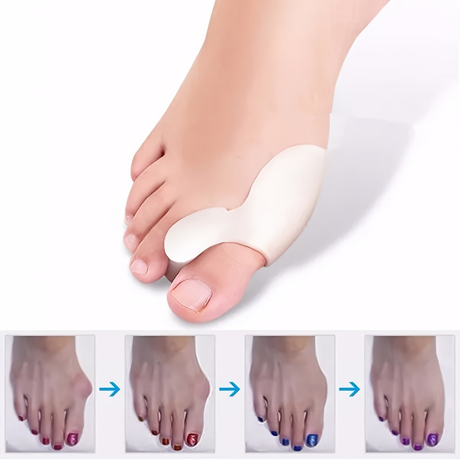 2pcs Hallux Valgus Silicone Toe Separator for Foot Care