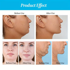 2pcs Silicone Jaw Line Exerciser Facial Muscle Chewing Ball