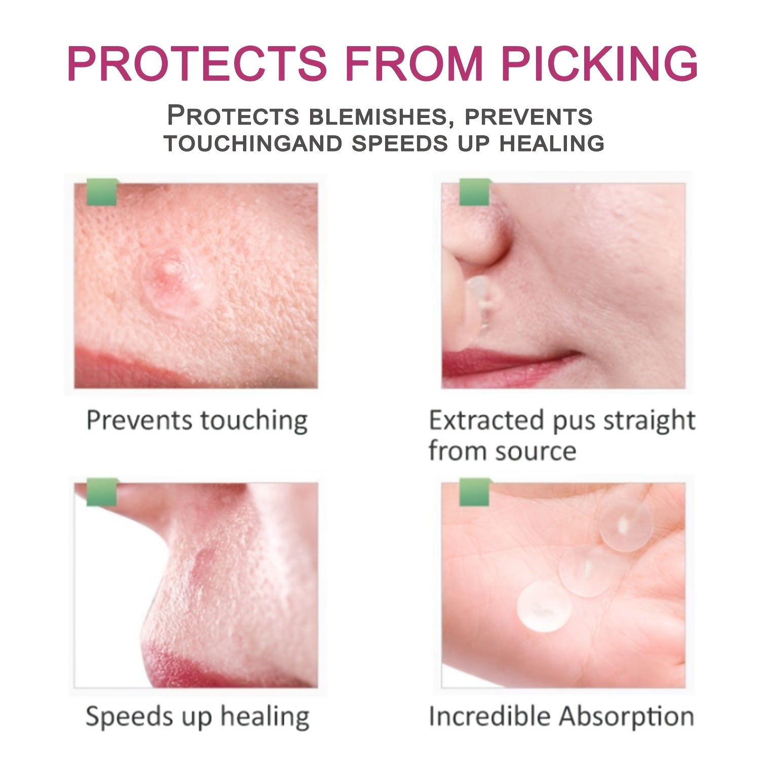 36 Ultra Thin Hydrogel Acne Patches 2 Sizes Waterproof Breathab