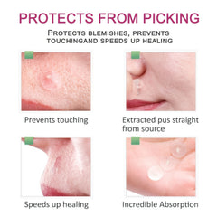 36 Ultra Thin Hydrogel Acne Patches 2 Sizes Waterproof Breathab