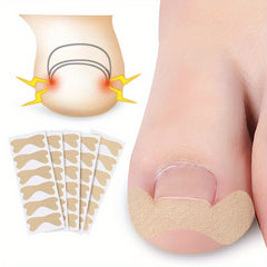 30pcs Toenail Corrector Patch Ingrown Toenail Corrector Sticker Nail Correction