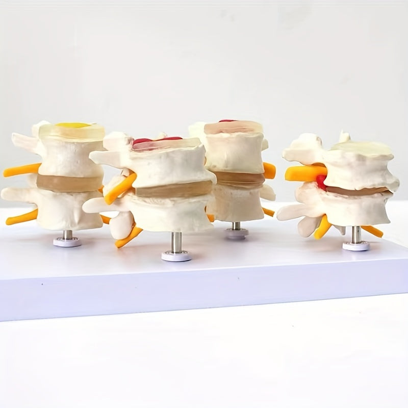 Lumbar Vertebrae Lesion Model Teaching Tool