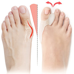 Toe Corrector Cushions for Night & Home Use