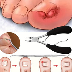 2Pcs Toe Nail Clippers For Ingrown Nails Thick Nails Cutters Dead Skin Dirt Remo