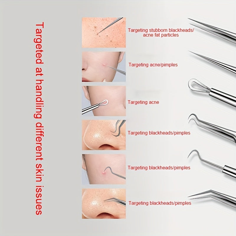 3-Piece Blackhead Remover Tweezers Set
