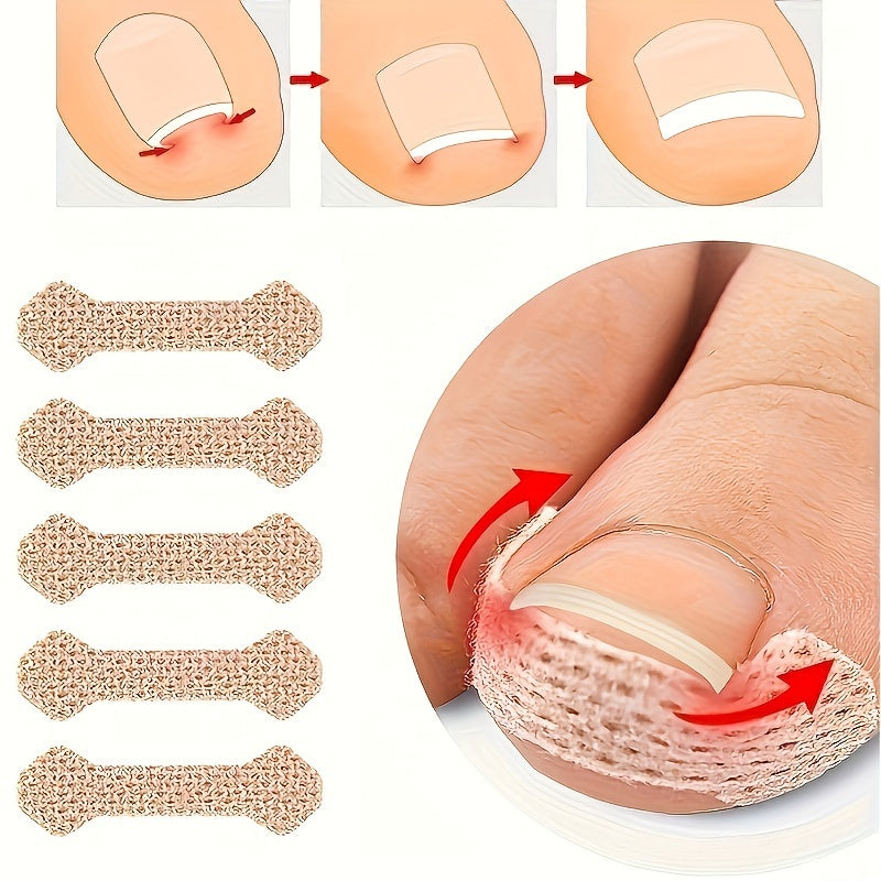 10pcs Nail Patch Toe Protection Sheet