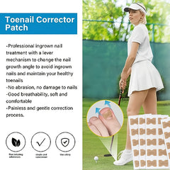 50pcs Glue Nail Correction Device Toe Nail Deformation Patch