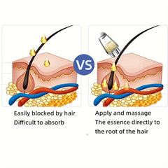 Mino Scalp Applicator for Hair Growth, Comb Roller Ball Massage