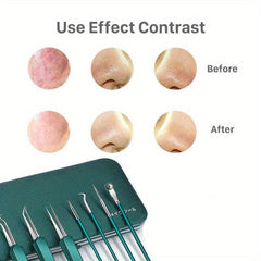 7pcs Precision Skin Care Tool Set for Beauty Needs HH9195