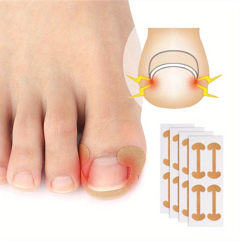 Ingrown Nail Correction Bone Patch Toenail Ingrown Nail Corrector Repair