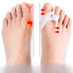 Toe Separator Silicone Corrector for Toe Correction