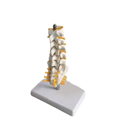 Lumbar Spine Model with Herniated Disc Sacrum & Nerves for Medical Education